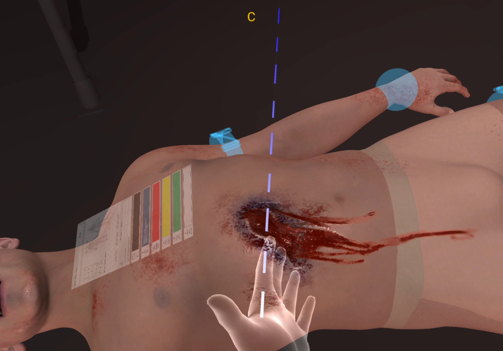 Triage Experiences